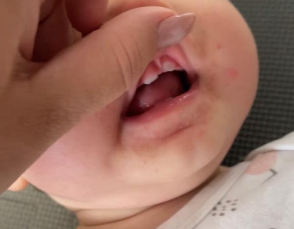 Bild zu Milchzähne kommen schief - Baby Forum - Allgemeine Themen