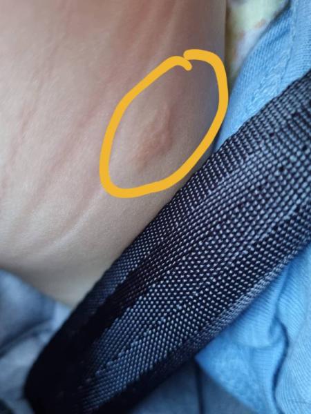 Bild zu Hautstelle-was könnte das sein? - Baby Forum - Allgemeine Themen