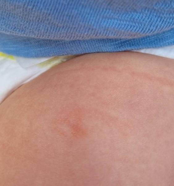 Bild zu 