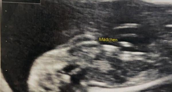 Bild zu Geschlecht - Baby Forum - Allgemeine Themen