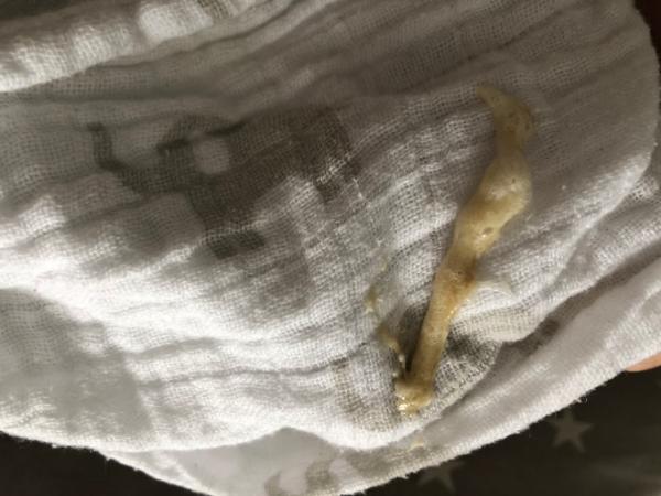 Bild zu Baby spuckt schleim ? - Baby Forum - Allgemeine Themen
