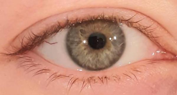 Bild zu Wimpern weg seit Schwangerschaft. Tipps? - Baby Forum - Allgemeine Themen