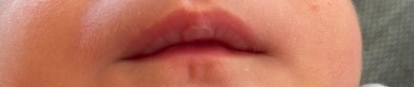 Bild zu Mundsoor?? - Baby Forum - Allgemeine Themen