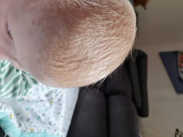 Bild zu Milchgneiß - Baby Forum - Allgemeine Themen
