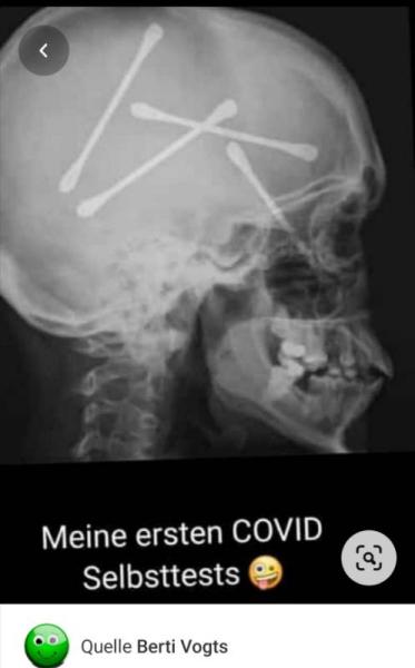 Bild zu 