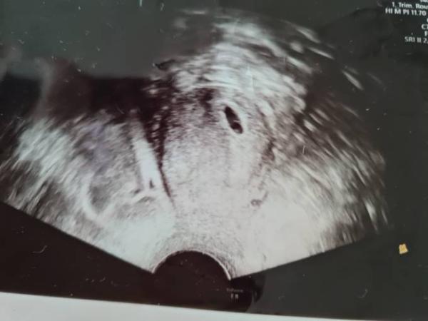 Bild zu Weit genug? - Baby Forum - Allgemeine Themen