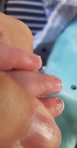 Bild zu Veränderung an den Fingernägeln, Baby 6 Monate - Baby Forum - Allgemeine Themen