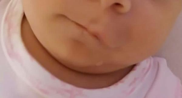 Bild zu Verformte Lippe :( - Baby Forum - Allgemeine Themen
