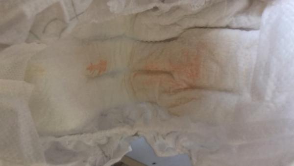 Bild zu Blut In der Windel ? - Baby Forum - Allgemeine Themen