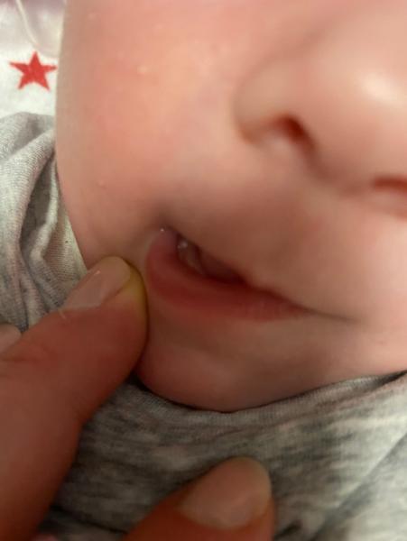 Bild zu Erster Zahn mit 9 Wochen?! - Baby Forum - Allgemeine Themen