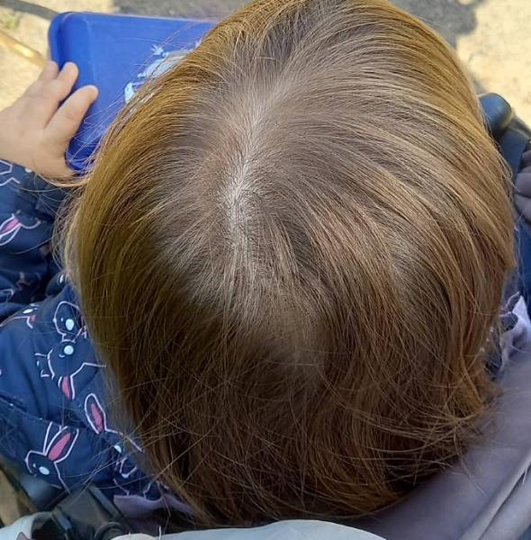 Bild zu Ist das Haar zu licht, Kleinkind fast 2,5 Jahre alt? - Baby Forum - Allgemeine Themen