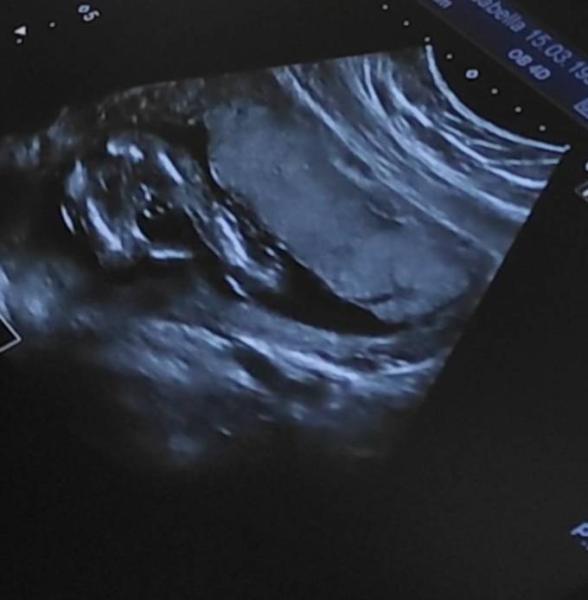 Bild zu 19 SSW - Baby Forum - Allgemeine Themen