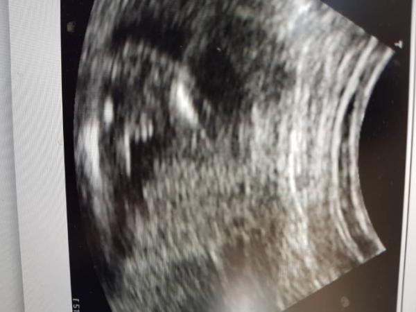 Bild zu Wer erkennt den Geschlecht? - Baby Forum - Allgemeine Themen