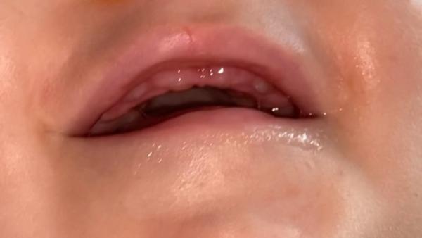 Bild zu Zähne ? - Baby Forum - Allgemeine Themen