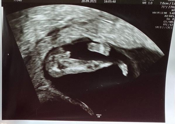 Bild zu Geschlecht đ„° - Baby Forum - Allgemeine Themen