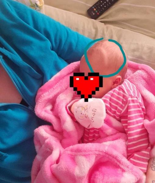 Bild zu Knochen um Fontanelle - Baby Forum - Allgemeine Themen