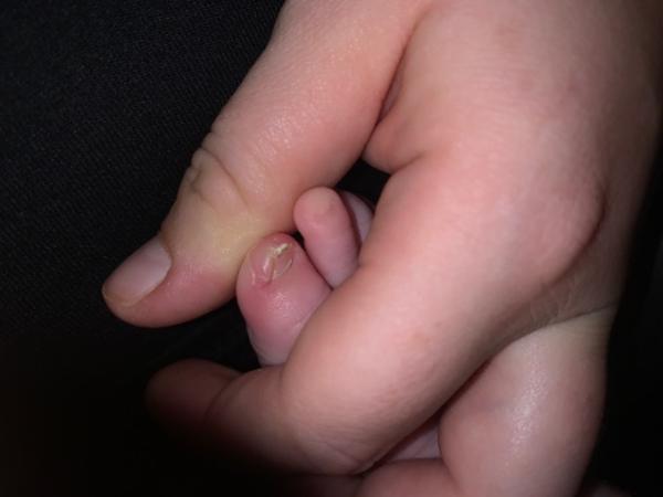 Bild zu Weis jemand was das sein könnte ? - Baby Forum - Allgemeine Themen