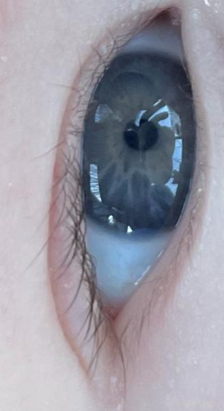 Bild zu Braune Augen? - Baby Forum - Allgemeine Themen