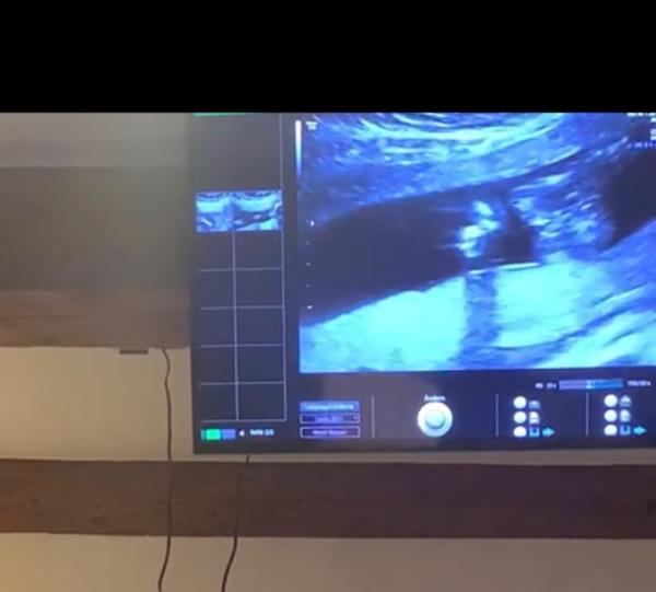 Bild zu Mädchen oder Junge ? 🌸💙 - Baby Forum - Allgemeine Themen