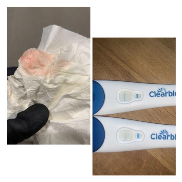 Bild zu Schwangerschafttest - Baby Forum - Allgemeine Themen