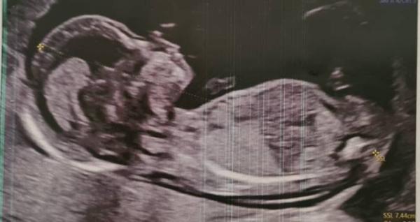 Bild zu Geschlecht erkennen - Baby Forum - Allgemeine Themen