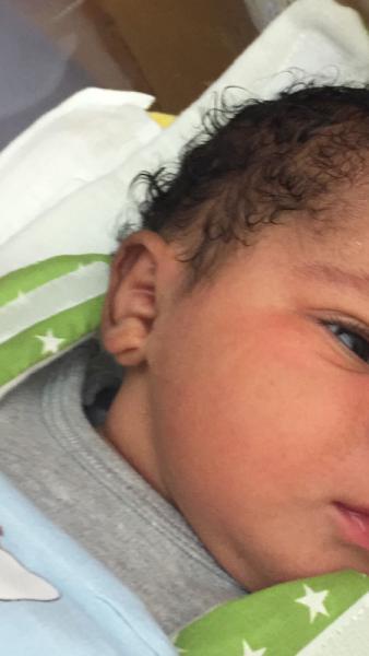 Bild zu Besonderes Ohrläppchen?! - Baby Forum - Allgemeine Themen