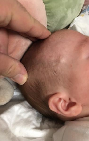Bild zu Beule am Kopf - Baby Forum - Allgemeine Themen