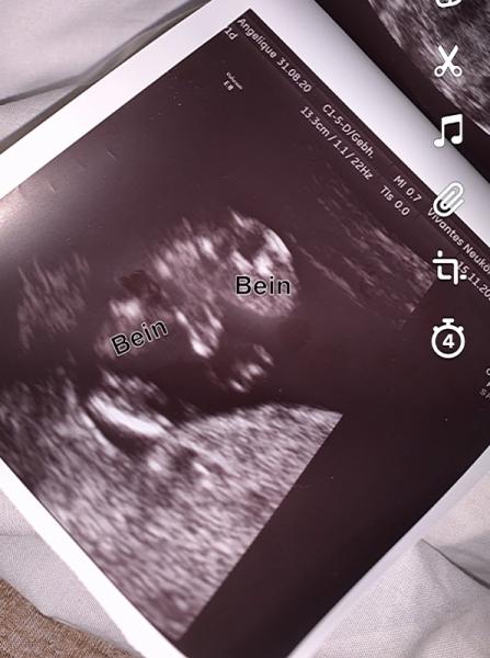 Bild zu Junge oder Mädchen? - Baby Forum - Allgemeine Themen