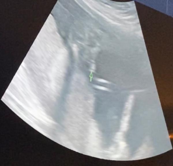 Bild zu Junge oder doch kein Junge ? - Baby Forum - Allgemeine Themen