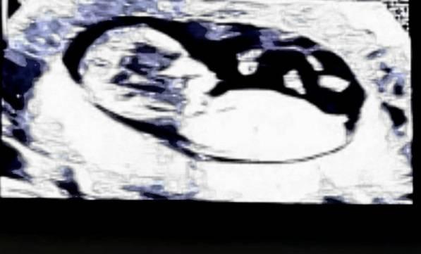 Bild zu Nub Theorie - Baby Forum - Allgemeine Themen