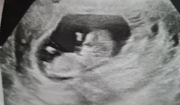 Bild zu Nub Theorie - Baby Forum - Allgemeine Themen