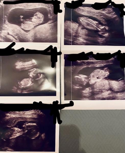 Bild zu Geschlecht... - Baby Forum - Allgemeine Themen