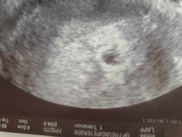 Bild zu Besteht noch Hoffnung? - Baby Forum - Allgemeine Themen