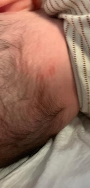 Bild zu Mein Sohn fasst sich die ganze zeit an Hinterkopf - Baby Forum - Allgemeine Themen