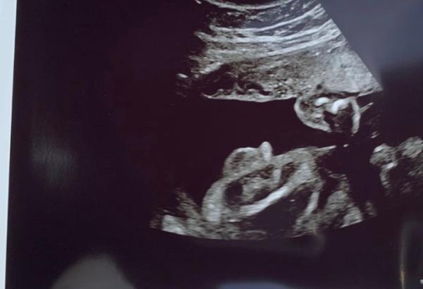 Bild zu Junge oder Mädchen? - Baby Forum - Allgemeine Themen
