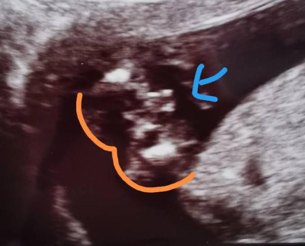 Bild zu Junge? - Baby Forum - Allgemeine Themen