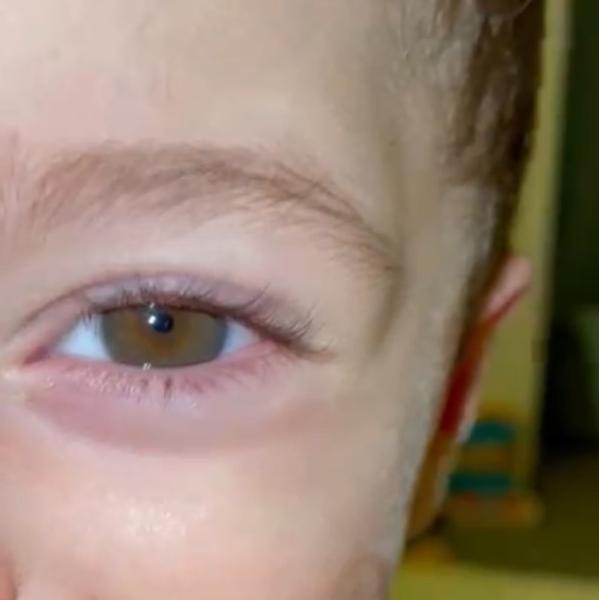 Bild zu Augenfarbe - Baby Forum - Allgemeine Themen