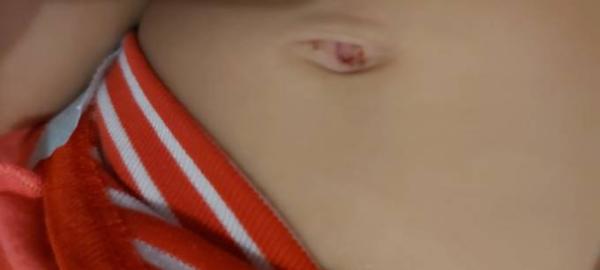 Bild zu Brauche Hilfe - Baby Forum - Allgemeine Themen