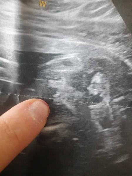 Bild zu Geschlecht - Baby Forum - Allgemeine Themen