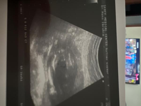 Bild zu Outting - Baby Forum - Allgemeine Themen