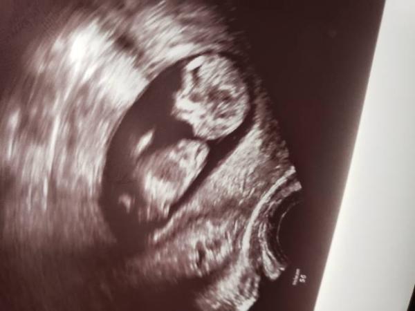 Bild zu Nub theorie - Baby Forum - Allgemeine Themen