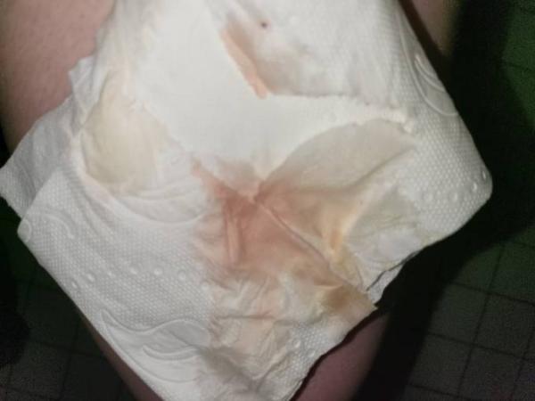 Bild zu Schwanger oder nicht? - Baby Forum - Allgemeine Themen