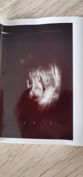 Bild zu Geschlecht? - Baby Forum - Allgemeine Themen