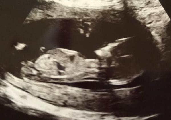 Bild zu Nub Theorie- Wer erkennt etwas? - Baby Forum - Allgemeine Themen