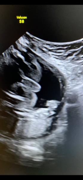 Bild zu 26 SSW junge oder Mädchen ?? - Baby Forum - Allgemeine Themen