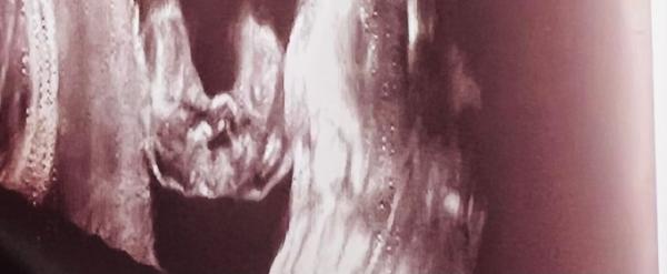 Bild zu Yx xx - Baby Forum - Allgemeine Themen