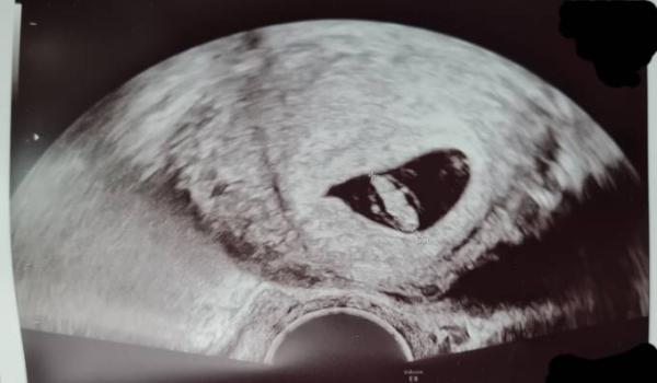 Bild zu Junge oder Mädchen? - Baby Forum - Allgemeine Themen