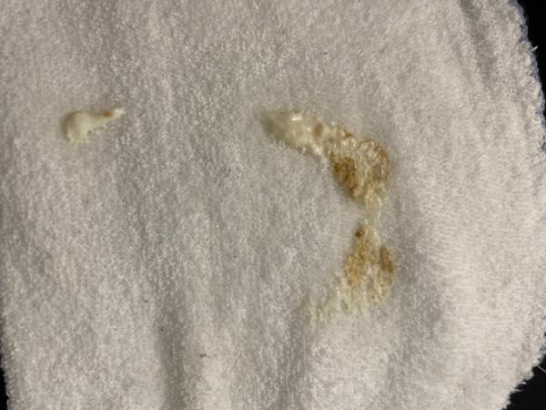 Bild zu Braun gespuckt?? - Baby Forum - Allgemeine Themen