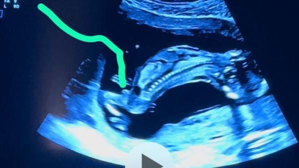 Bild zu Junge oder Mädchen ? - Baby Forum - Allgemeine Themen