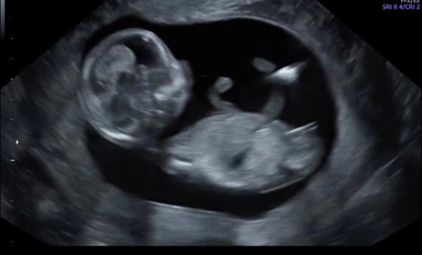 Bild zu Geschlecht - Baby Forum - Allgemeine Themen